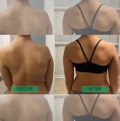 Unisex Anti-Humpback Chest Lift Brace Posture Corrector